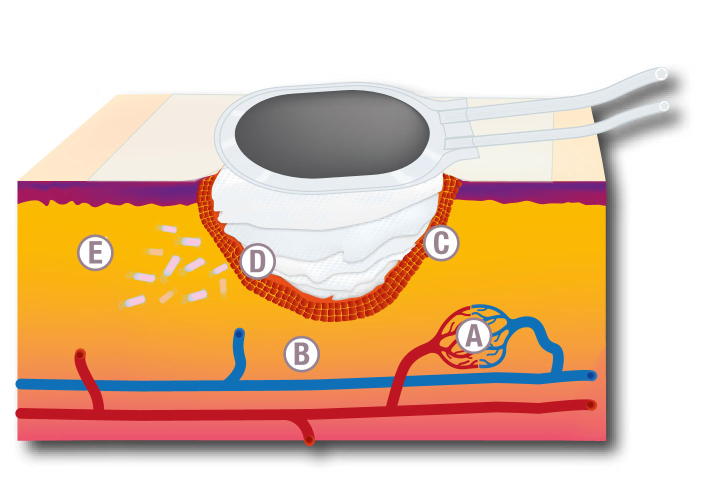 CADITEC WaterlilyTS-Infografik